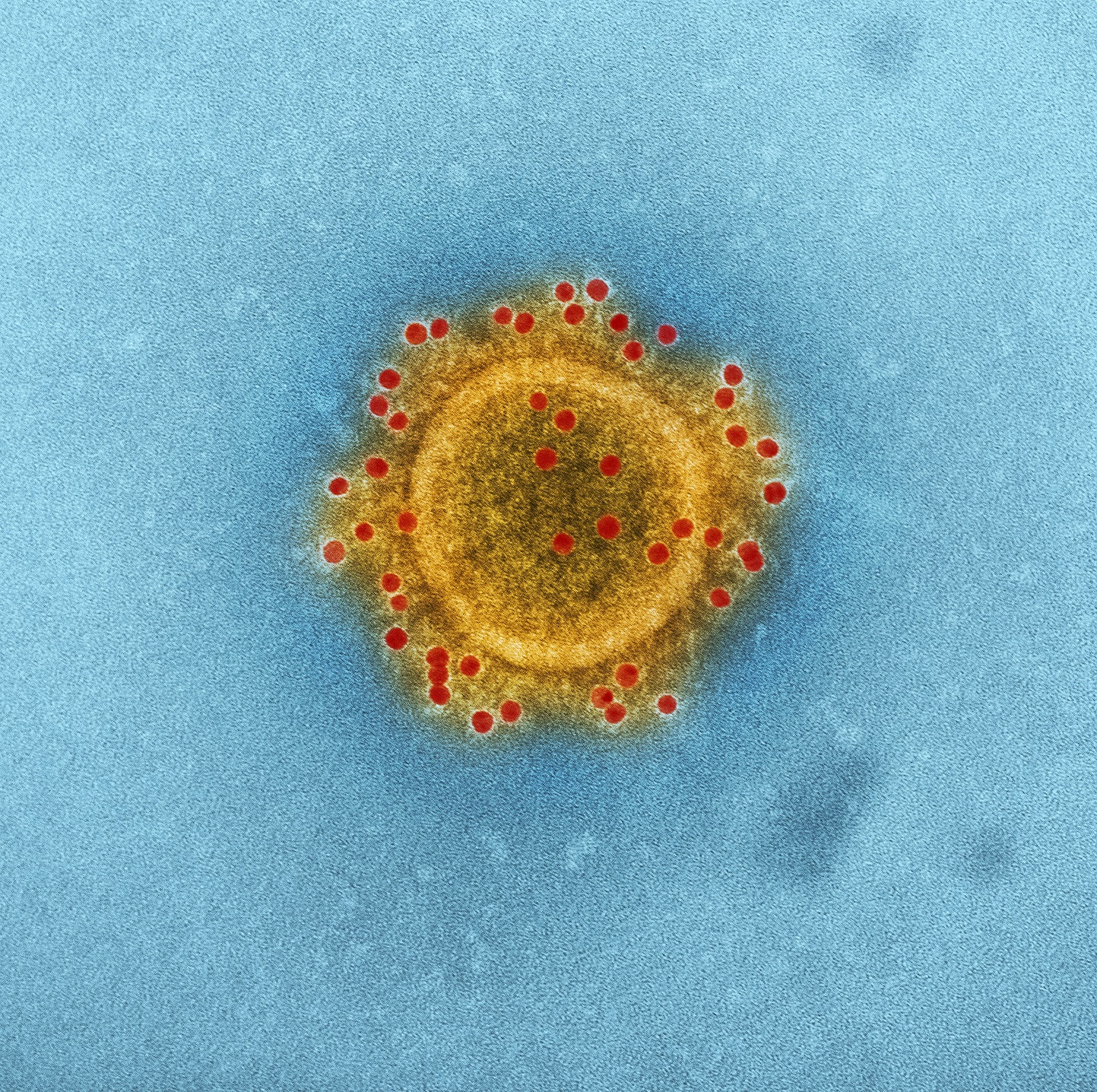Vasomune’s Lead Investigational Medication is Connected to the Fight Against Coronavirus